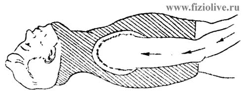 Массаж: Гипсовые повязки при переломах (вывихах) шейных позвонков