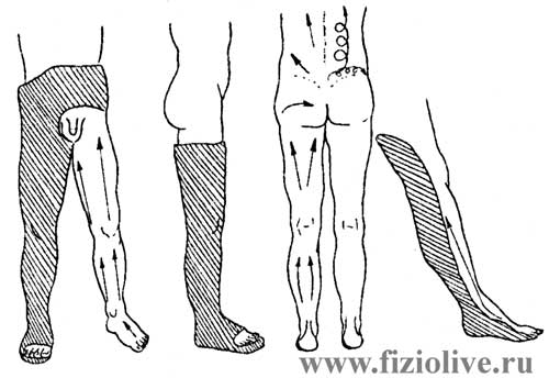 Массаж: Гипсовые повязки при переломах (вывихах) костей нижней конечности