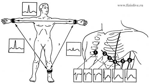 The scheme of electrodes ECG