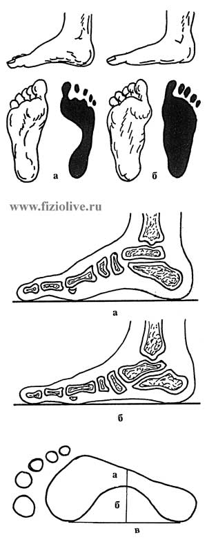 The appearance of the feet and their prints