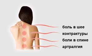 Заболевания спины