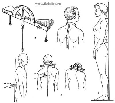 定义侧curvatures的脊椎