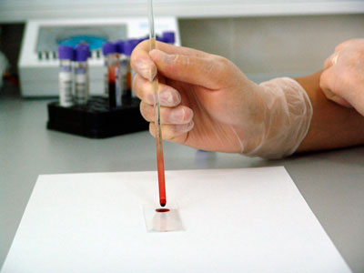 Анализ крови для проведения врачебного контроля