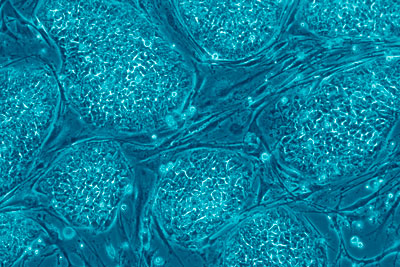 Экспериментальные исследования по применению стволовых клеток